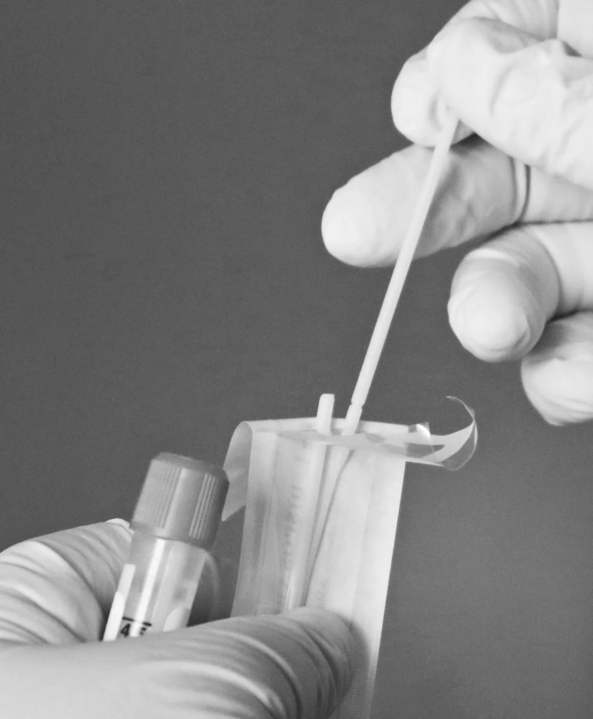 genetic test fo hair loss.jpg