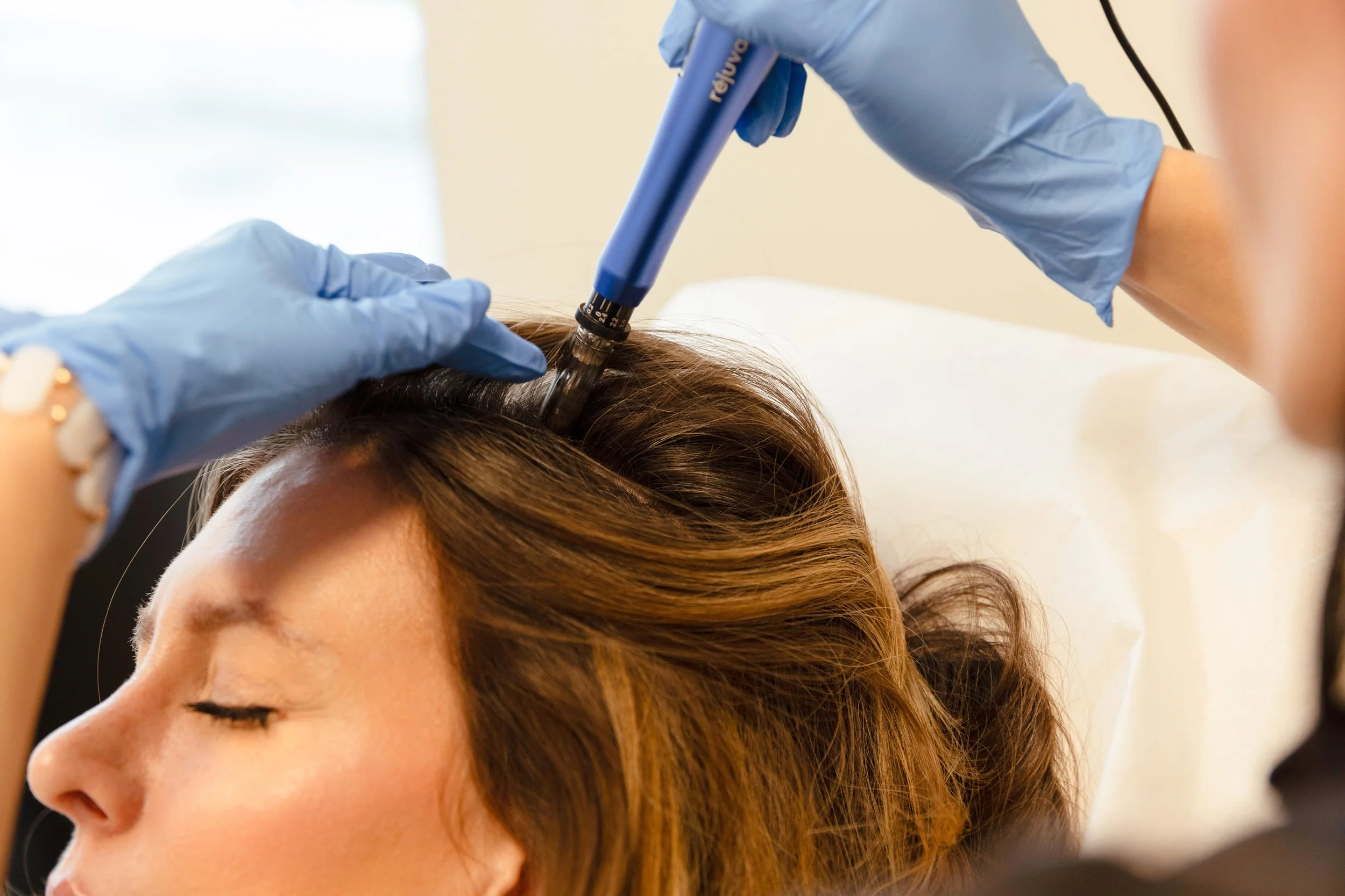 a woman getting secretome therapy scalp treatment in scottsdale