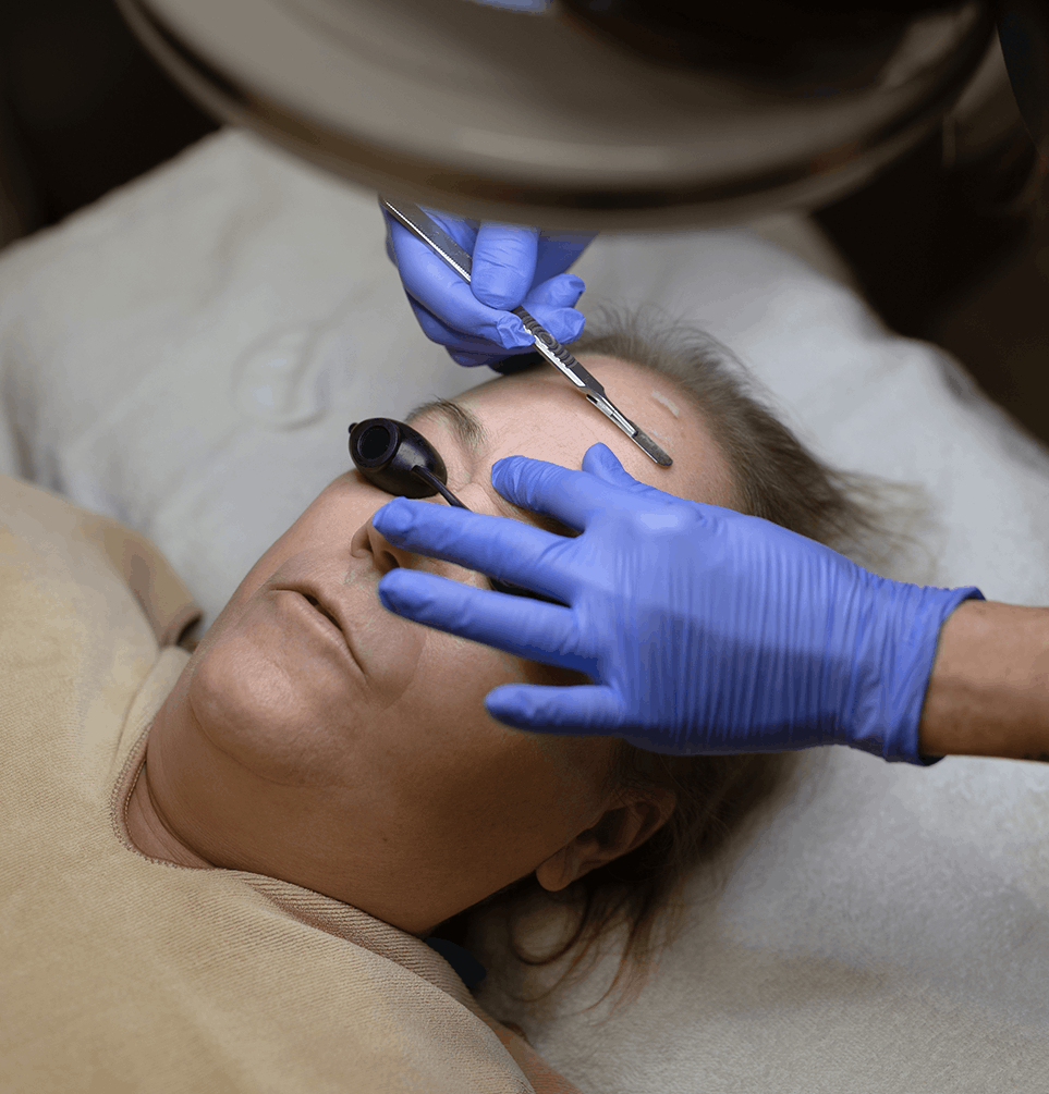 dermaplaning facial.png