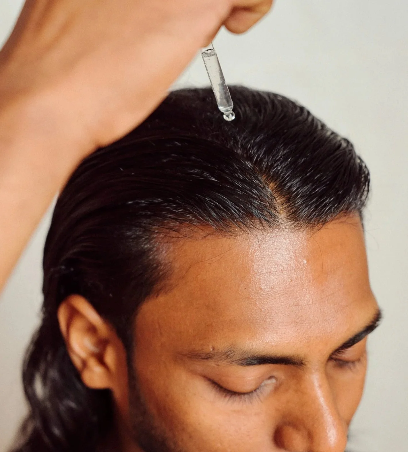 custom+hair+loss+topical+for+men.jpg