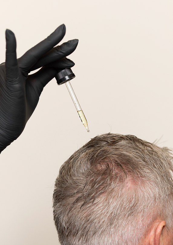 nhlma hair loss expert