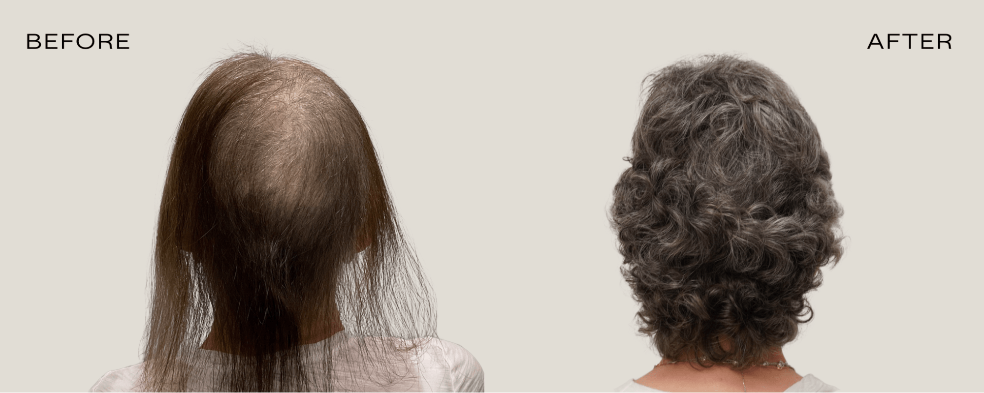 hair growth plateau female hair