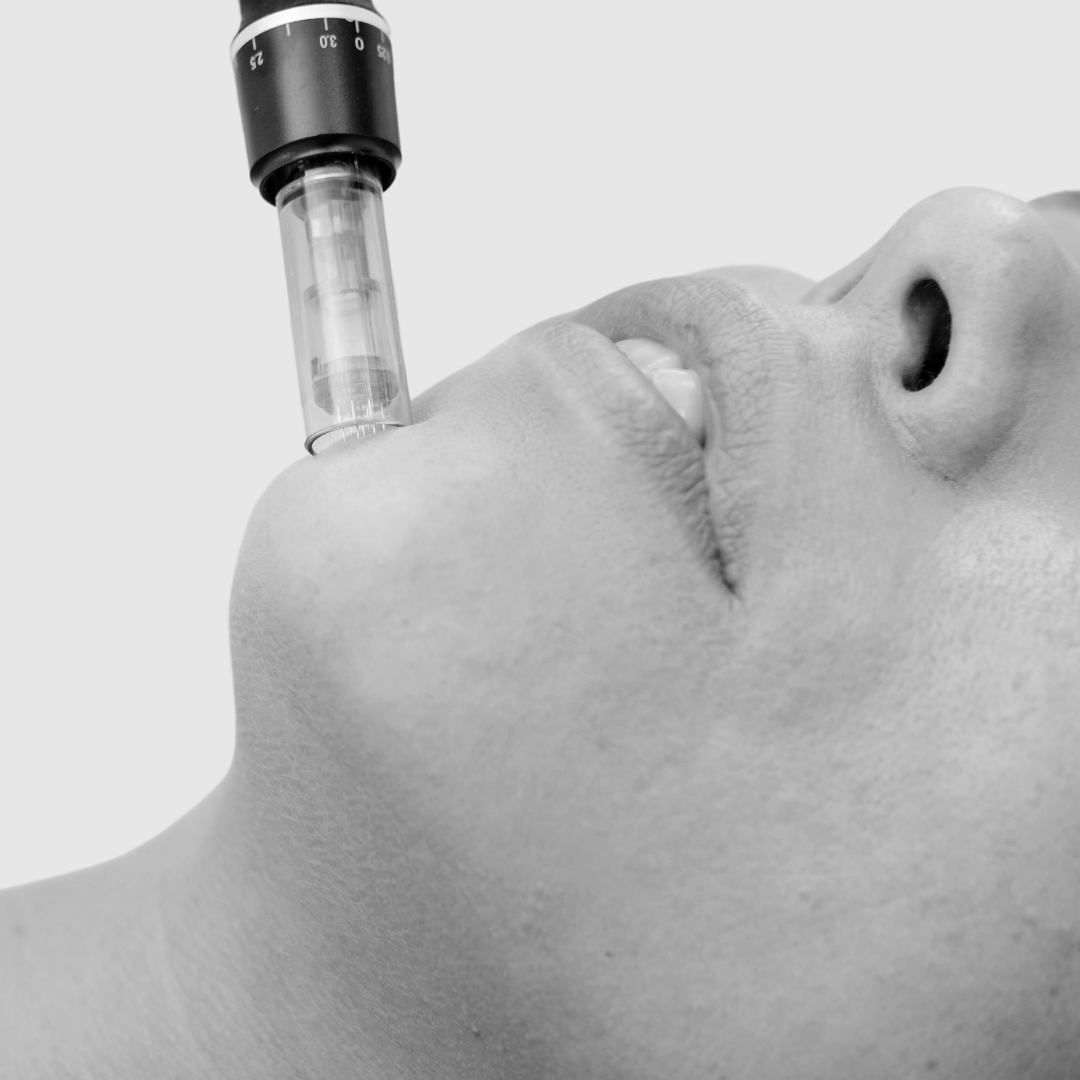 Medical Microneedling Packages