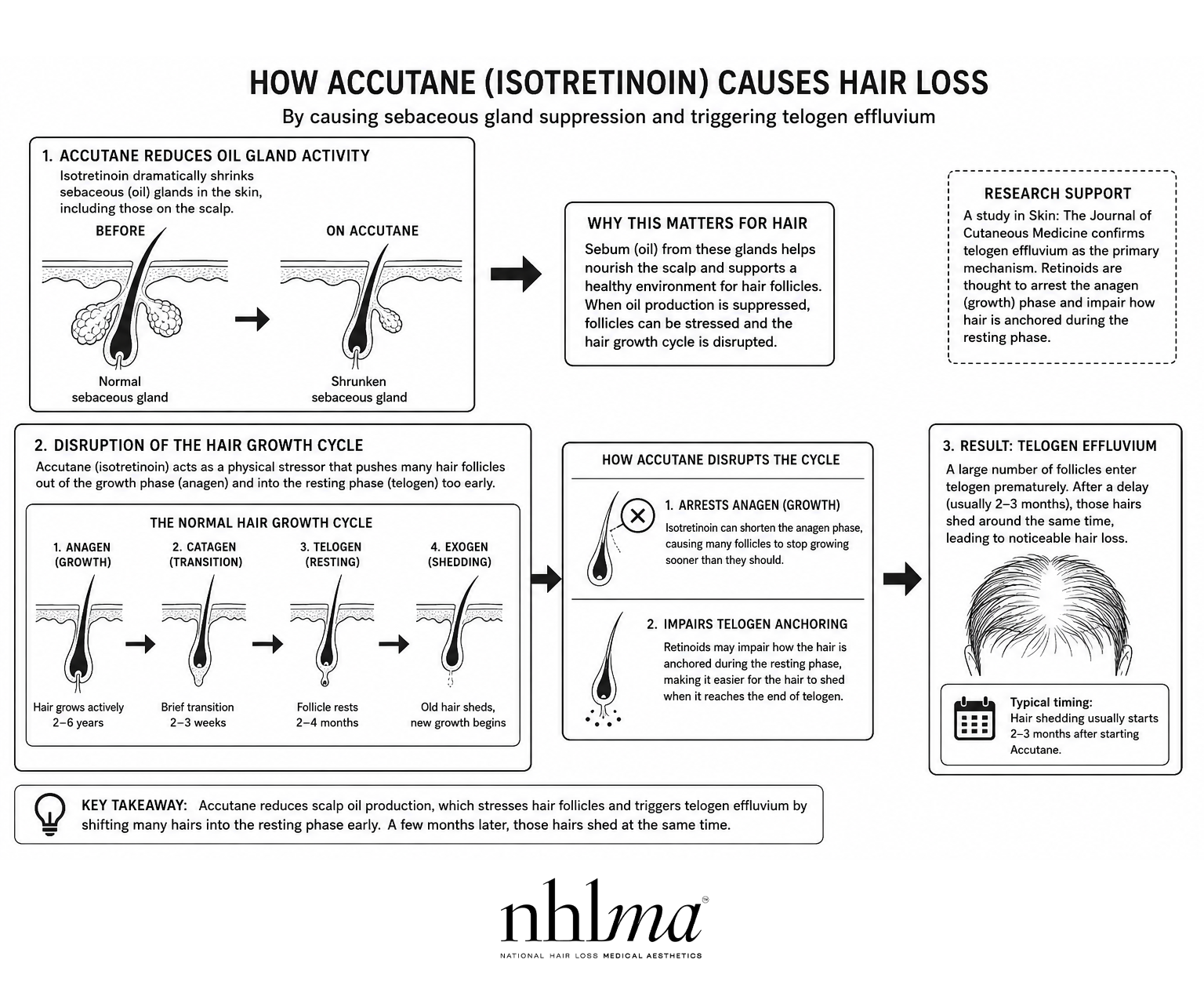 a diagram of how accutane isotretinoin causes hair loss from NHLMA