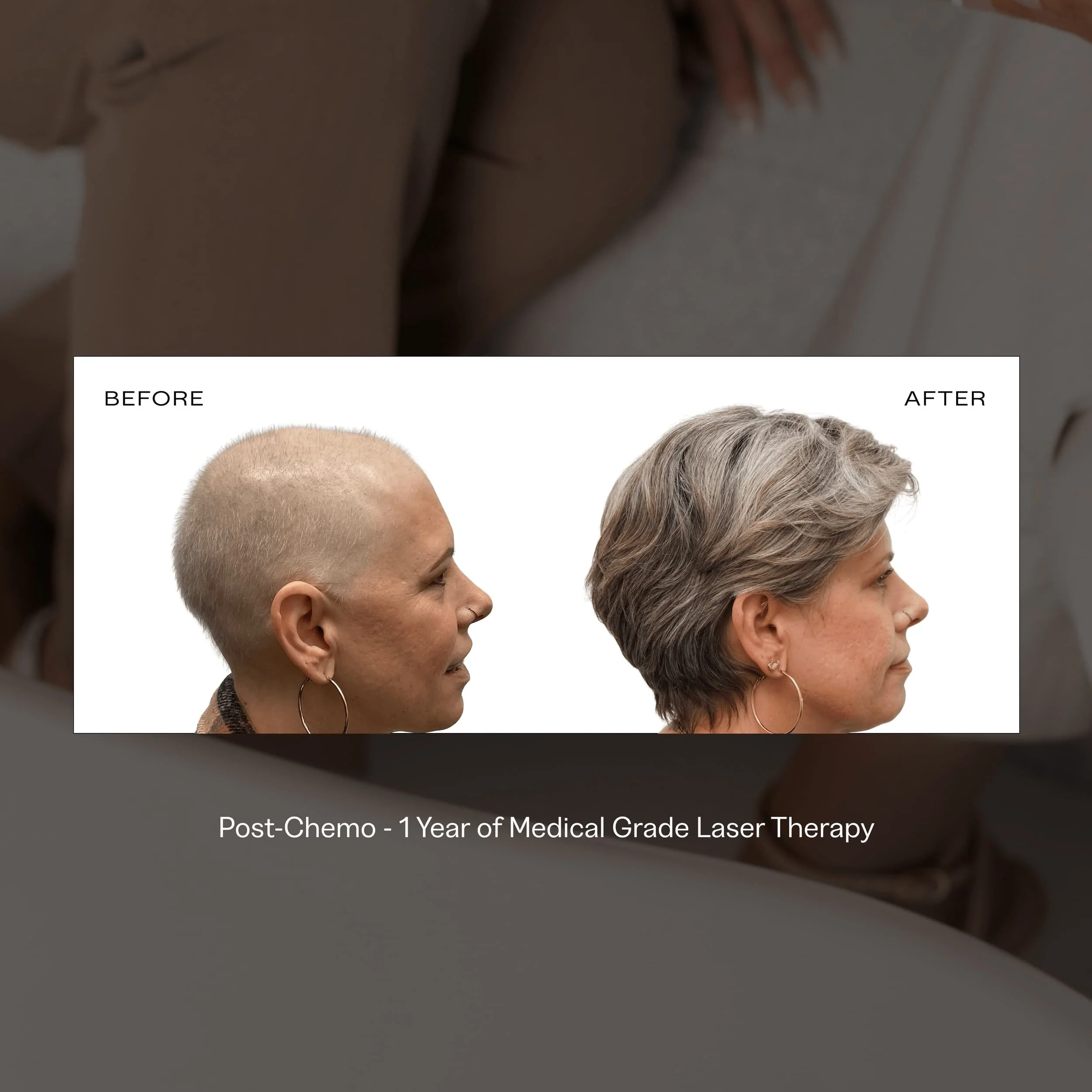 helmet for laser hair loss.jpg