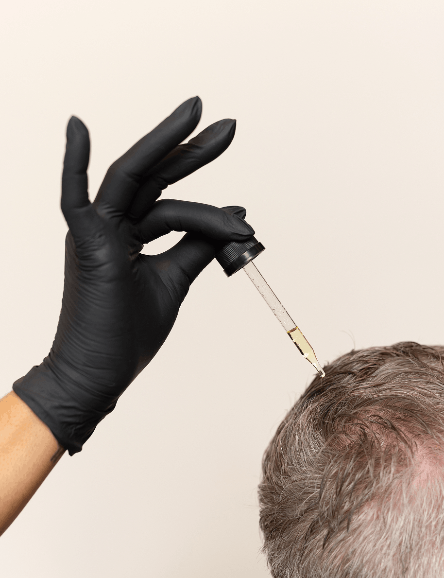 hair loss clinic scottsdale hair restoration