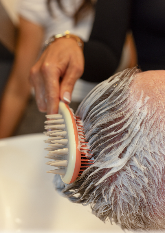 nhlma hair loss expert