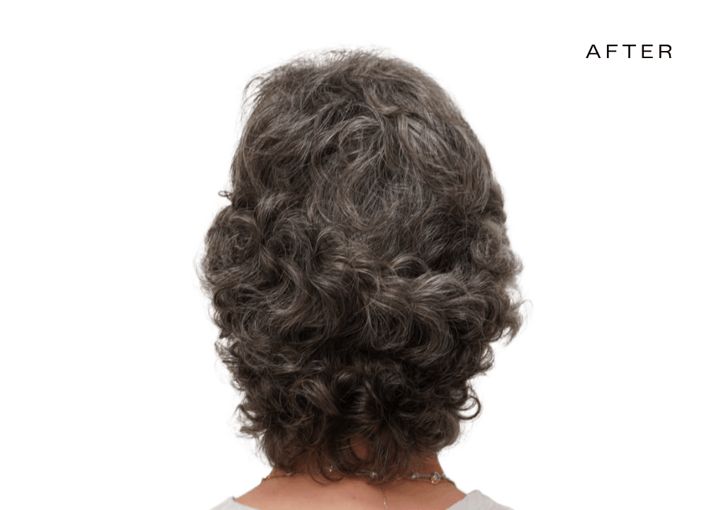 female hair loss experts scottsdale