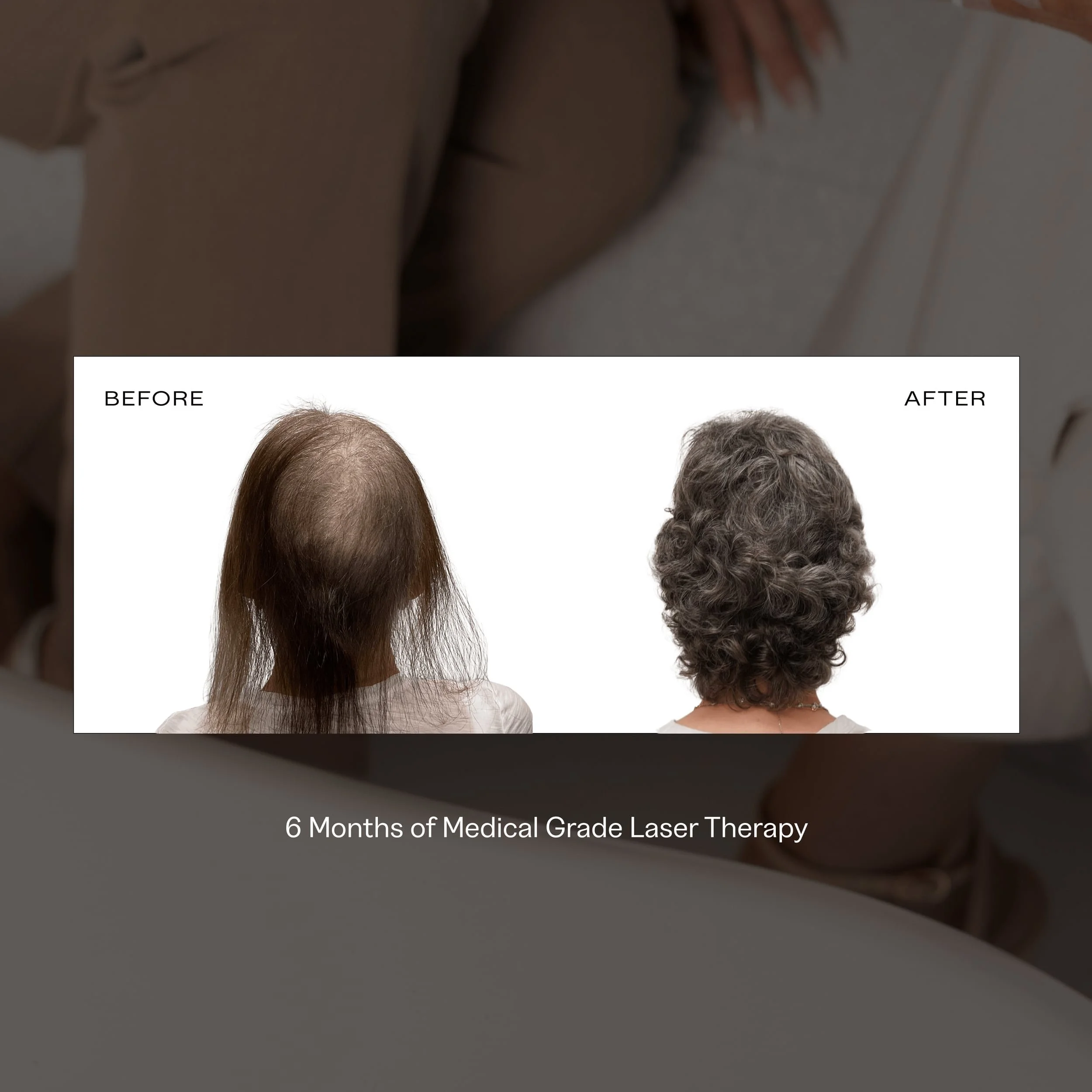 laser cap before and after.jpg