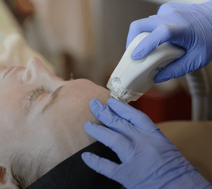 laser skin resurfacing scottsdale