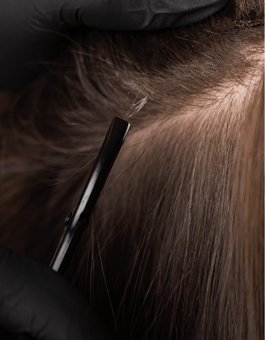 hair follicle test for hair loss