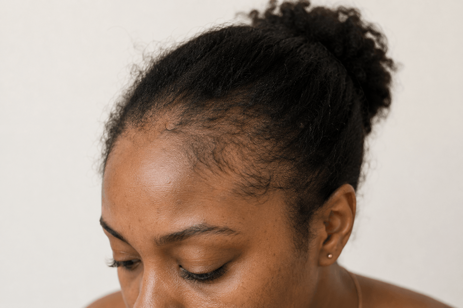 early signs of hair loss you shouldnt ignore