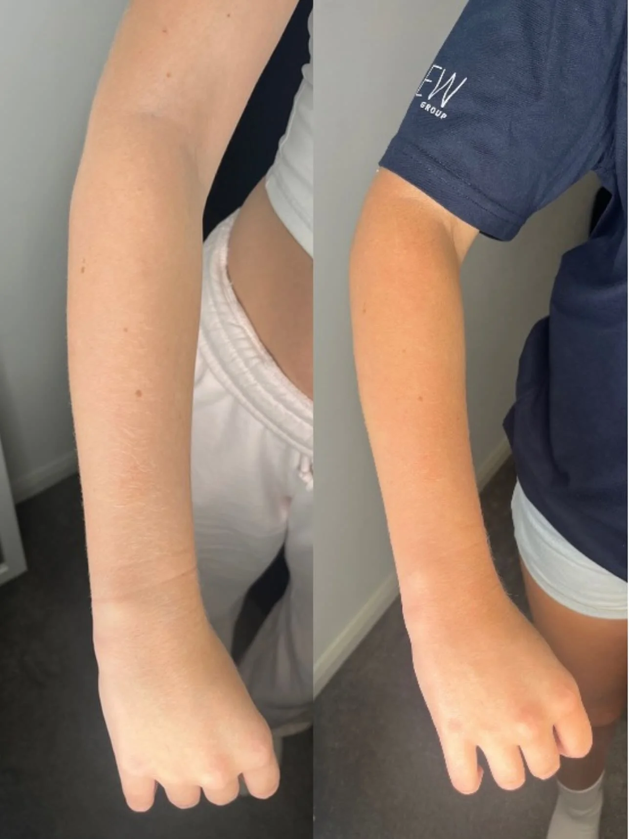 A little ✨before and after✨ from one of my spray tan clients today!
I offer a range of different Sienna X spray tan percentages to suit everyone.. this client wanted a natural glow, so that’s what she got!
📍visit my website in my bio! Or d