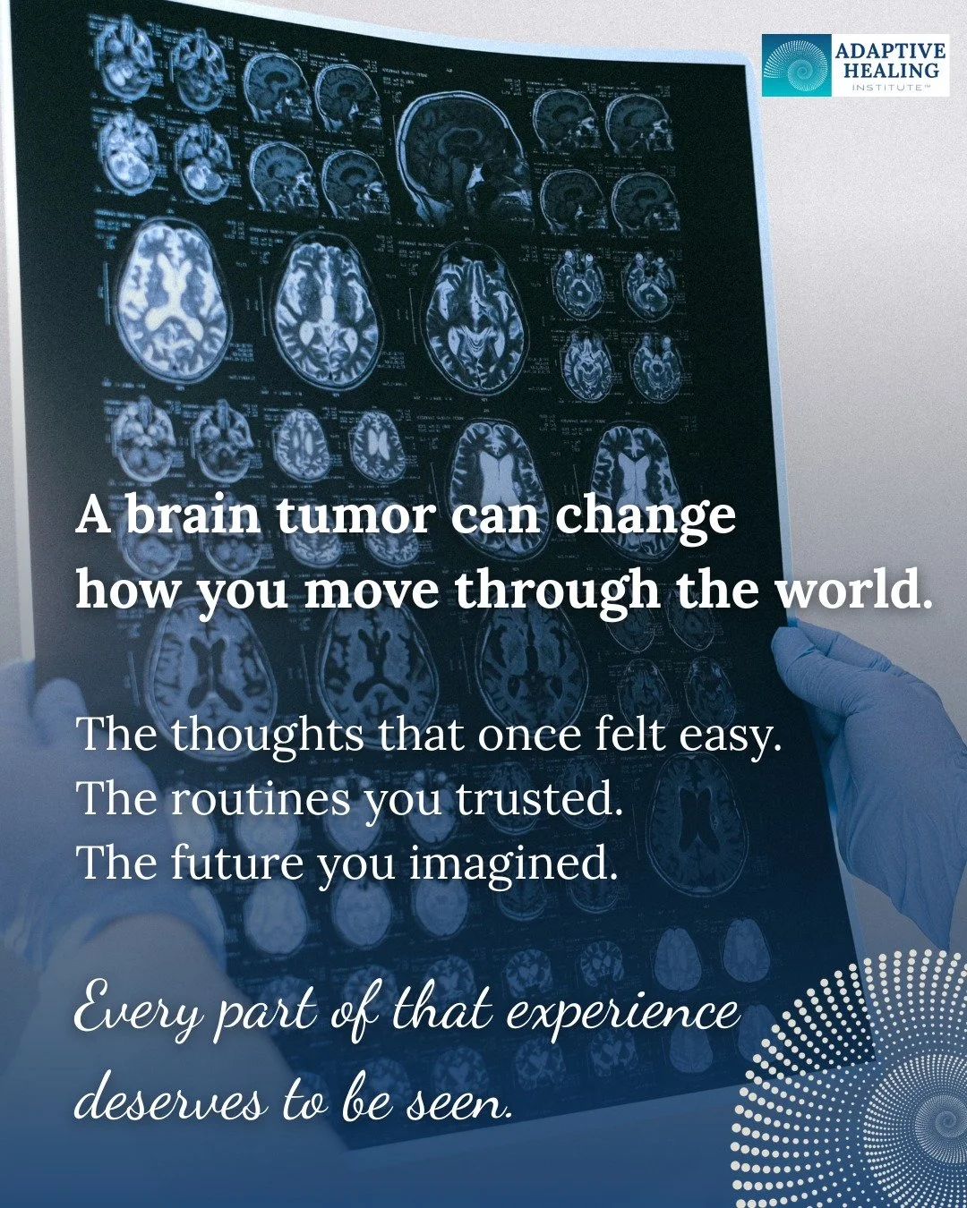 A brain tumor diagnosis affects far more than physical health. I have seen firsthand the vast physical, mental, and emotional swings that can happen when someone you love is navigating something this life-changing.

It changes routines, relationships