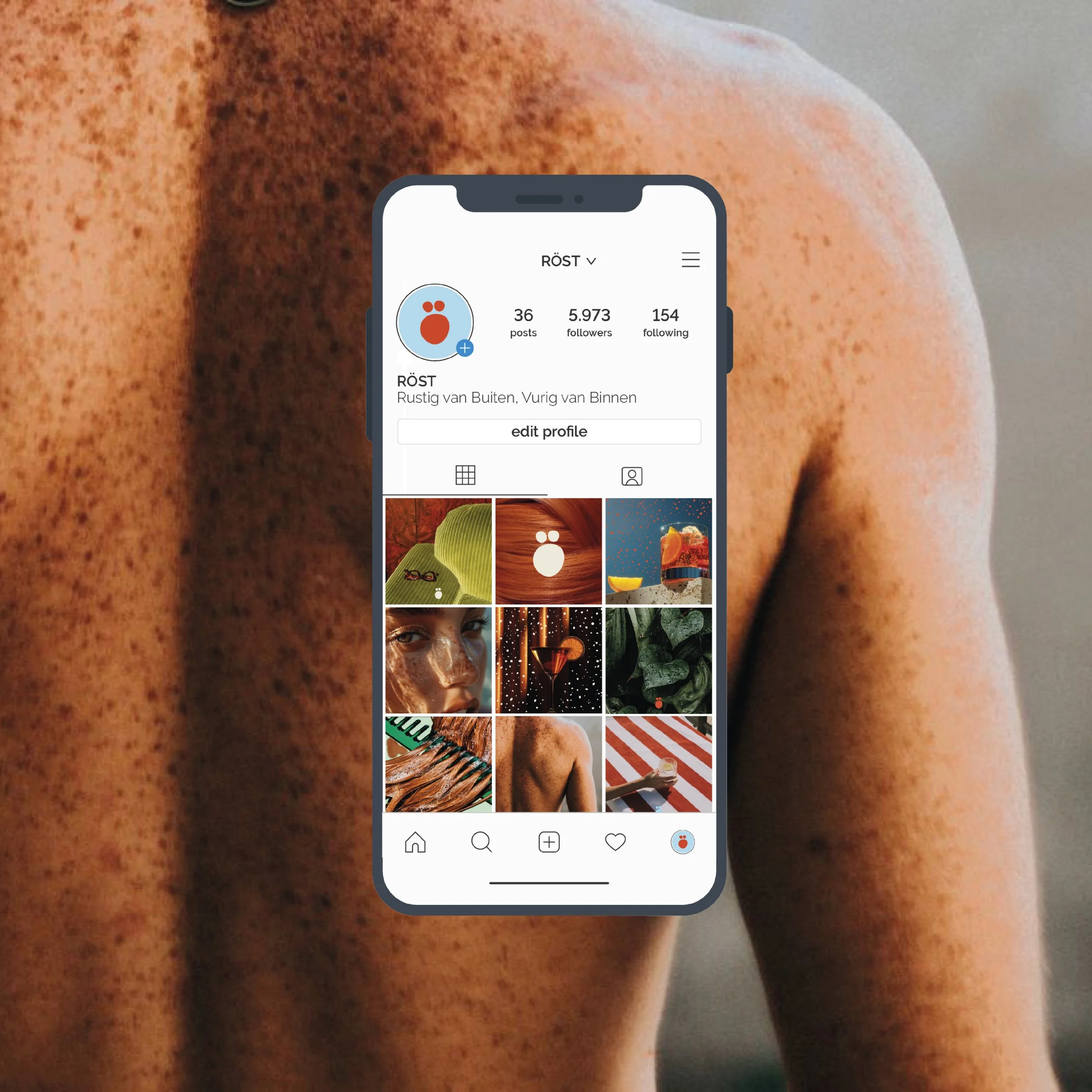 Smartphone displaying a social media profile over a person's freckled skin, showing photos of various objects and scenes.