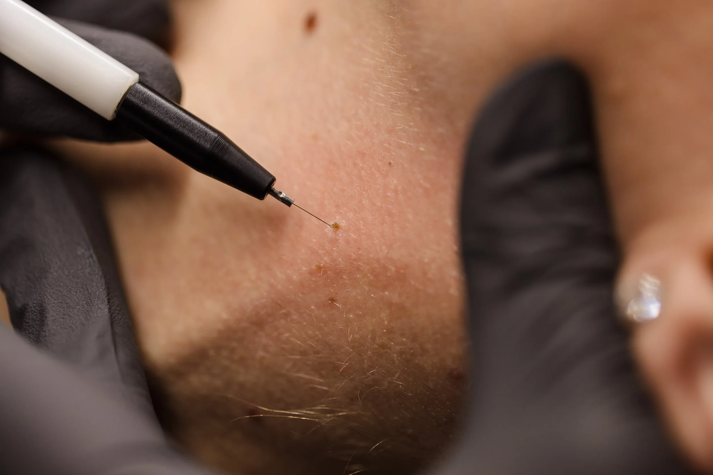 Close up of ThermoClear Pro Pen