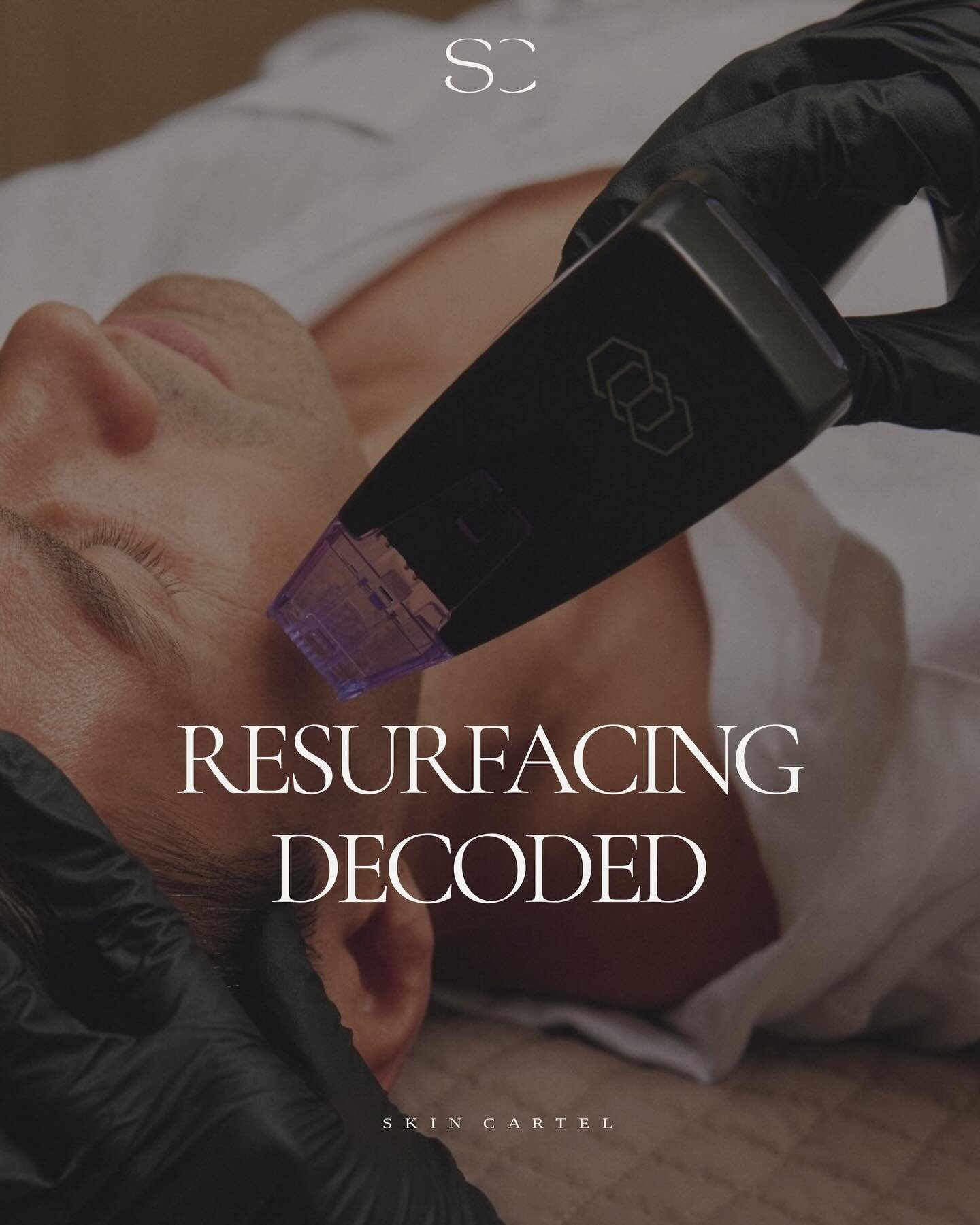 Skin resurfacing often sounds more intense than it actually is.

In reality, it&rsquo;s one of the most effective ways to improve texture, congestion, dullness, and uneven tone especially after a busy December of heat, sun exposure, and heavier skinc