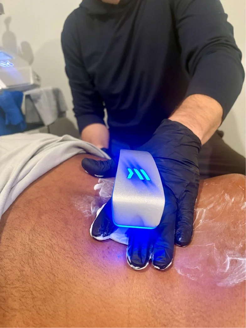 A person wearing black gloves applies a treatment to a person's back using a device emitting blue light.