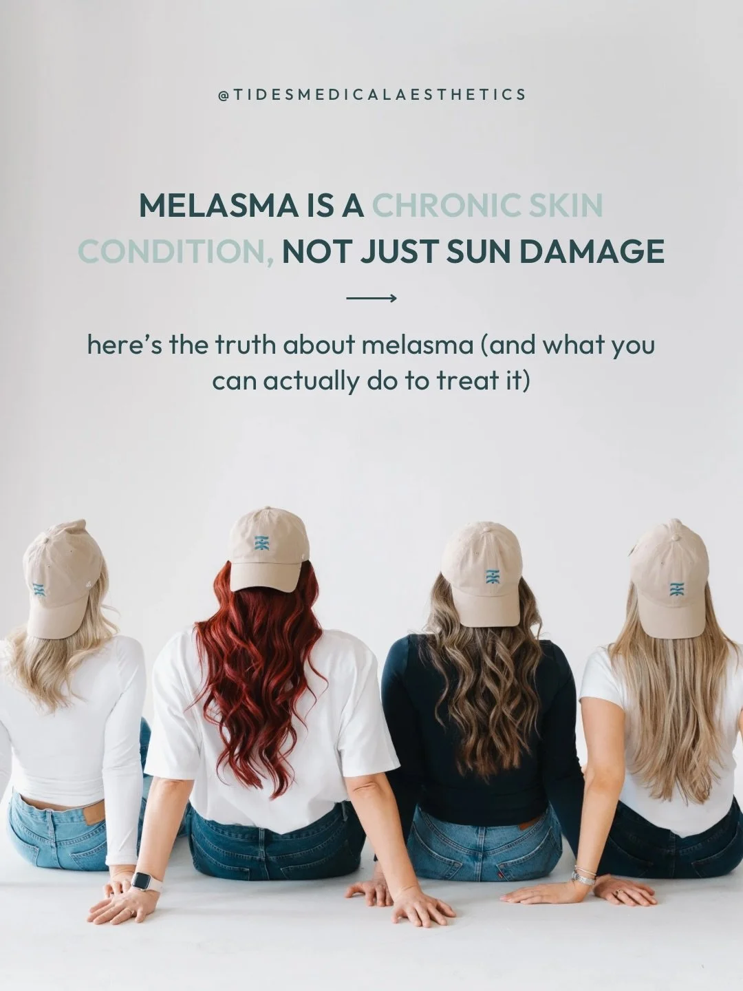 Melasma is incredibly common but so often misunderstood. Prevention is easier than correction, always, but when dealing with melasma it can feel a lot more complex than that. 

If you struggle with this skin condition, please don&rsquo;t hesitate to 