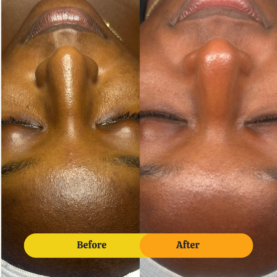The Best Daily Routine for Fading Dark Spots