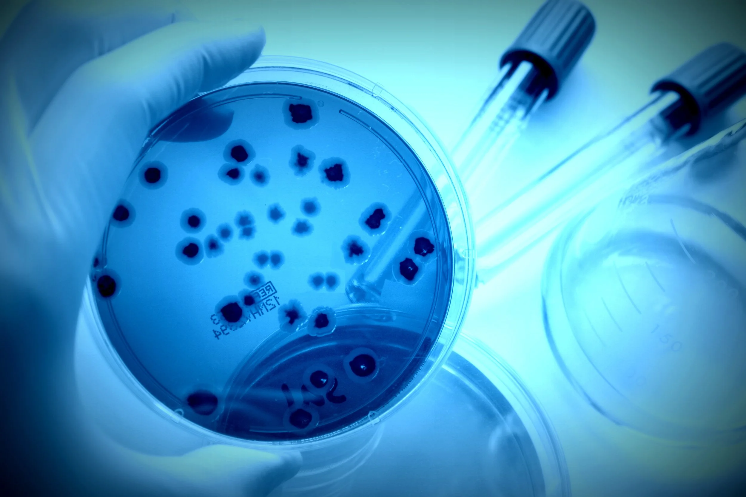 A gloved hand holding a petri dish with dark bacterial colonies, with two syringes and a beaker nearby on a lab table, under blue lighting.