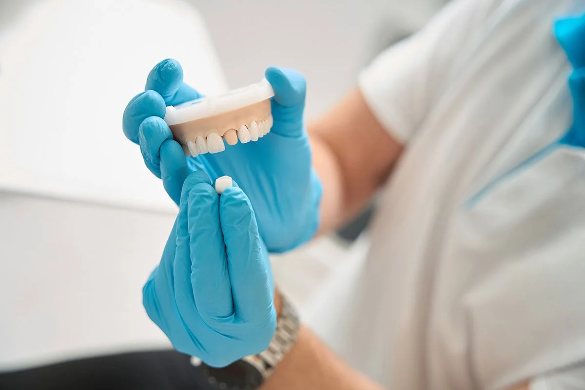 When Does a Tooth Need a Dental Crown Instead of a Filling?