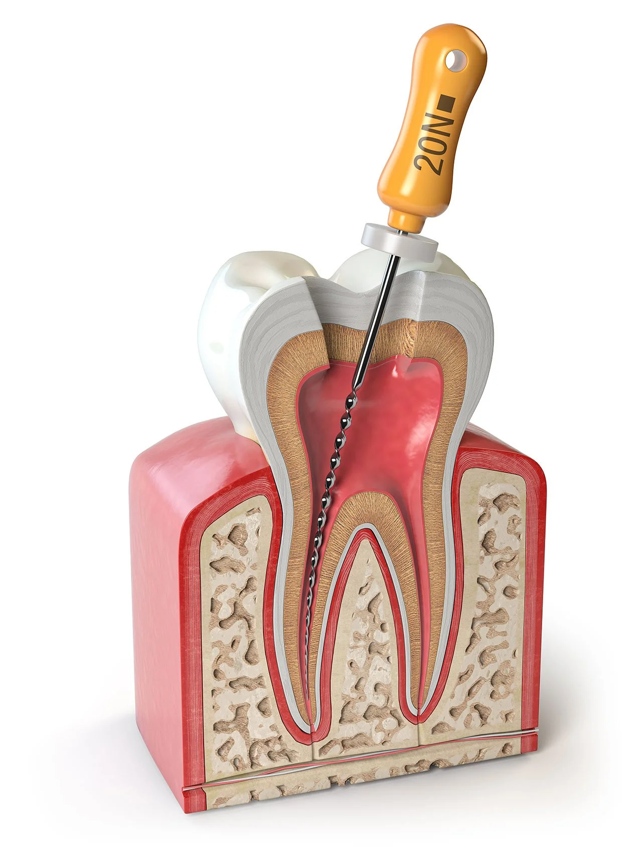 Same-Day Root Canal Treatment FAQs