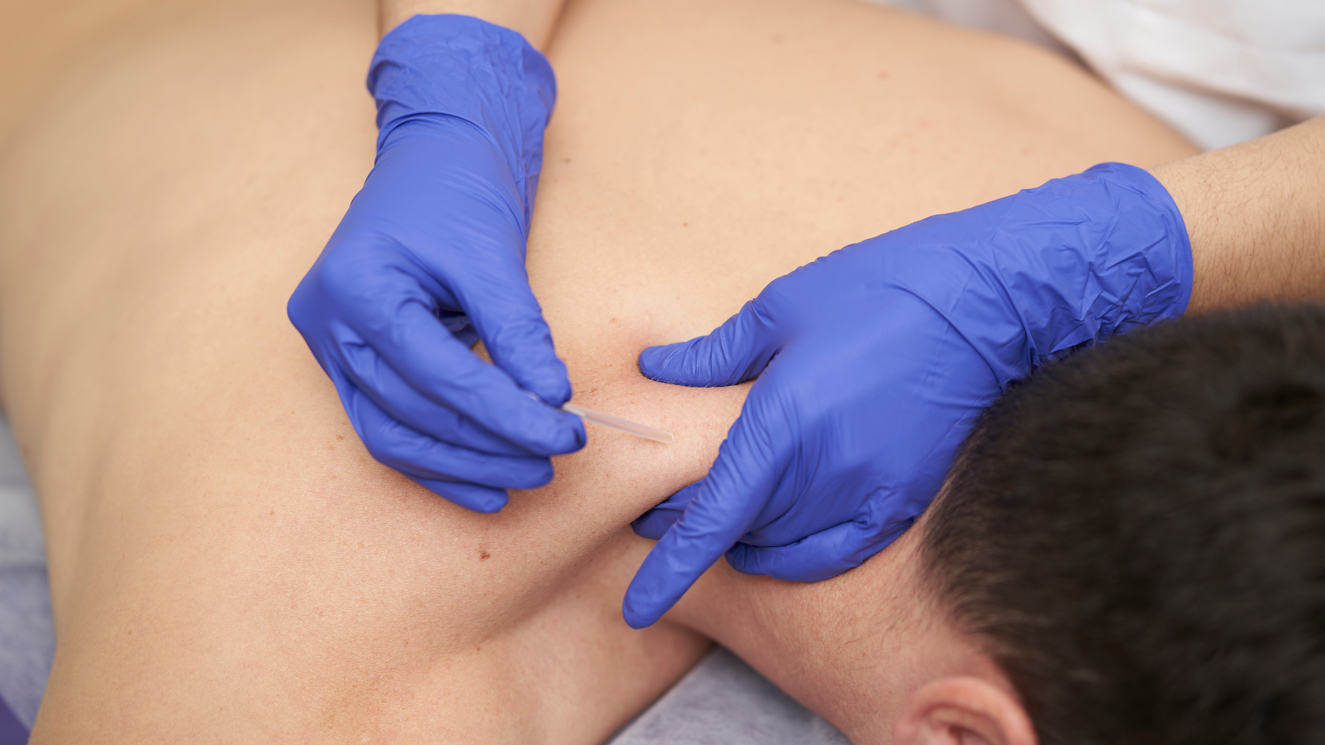 That Knot in Your Shoulder? We Can Fix It. TODAY.