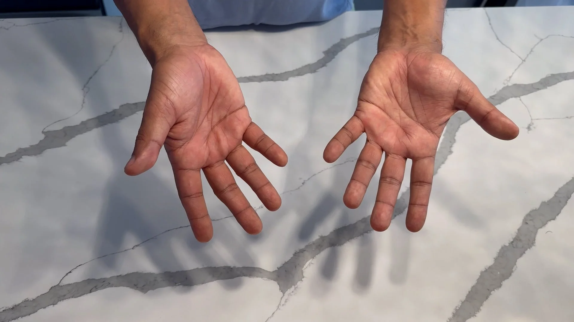 Front of the hand
