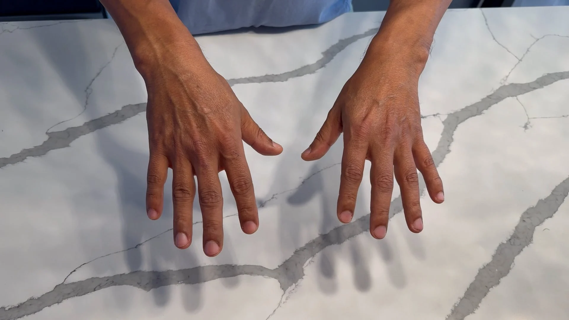 Back of the hands