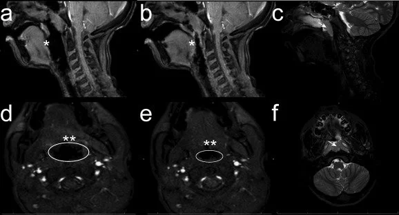 cineMRI.jpg