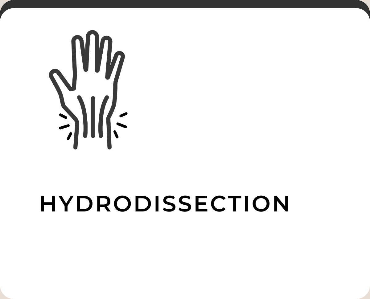 hydrodissection wrist manhattan health manhattan medicine