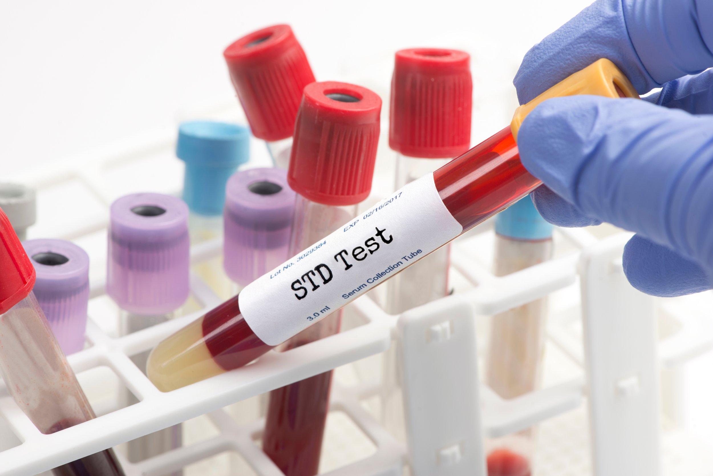 STD Comprehensive