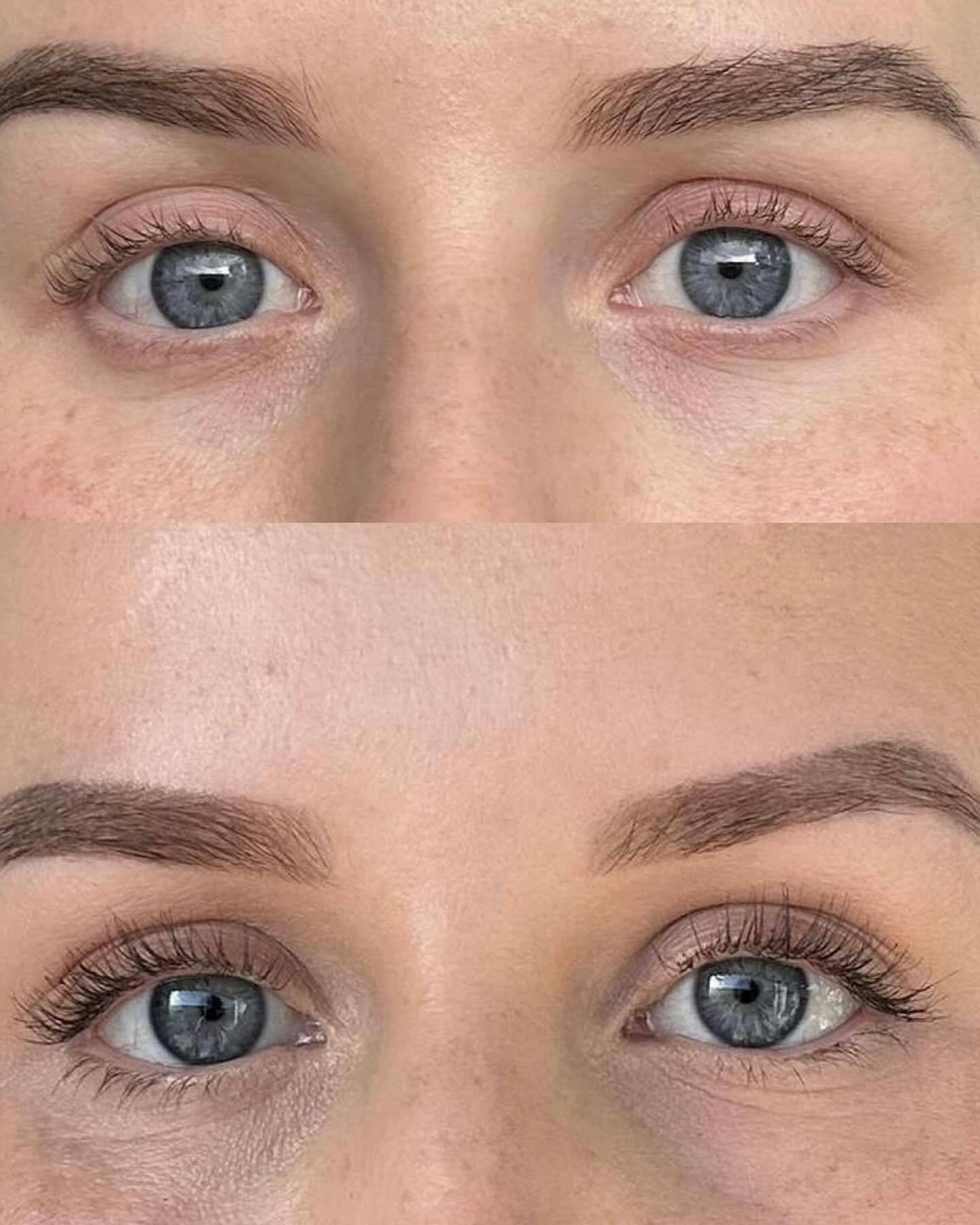 👀 We are LOVING your before and after pictures! Available at @luxeaestheticsnz and online very soon 👀 🩵