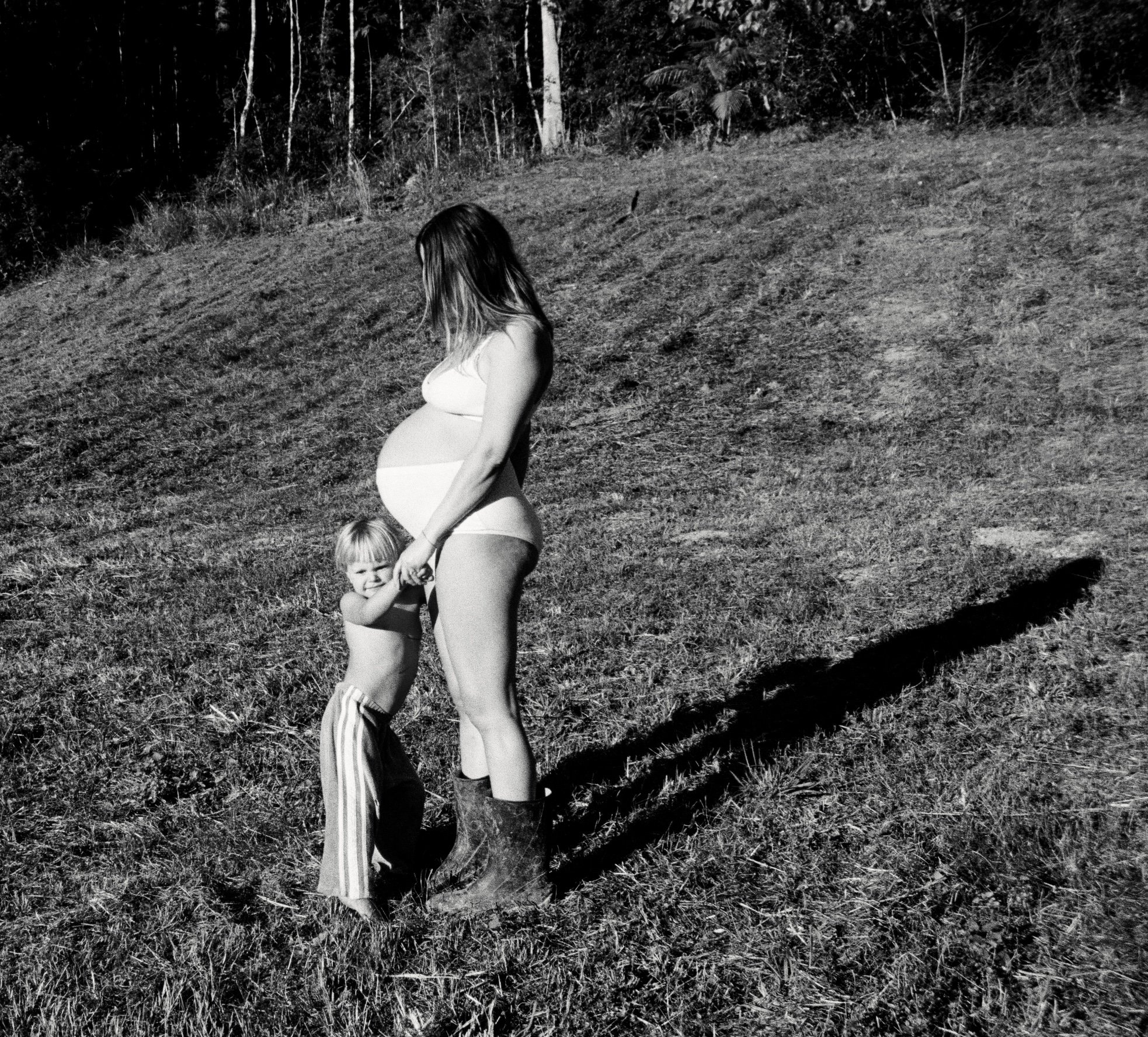 Iron Infusions in Pregnancy