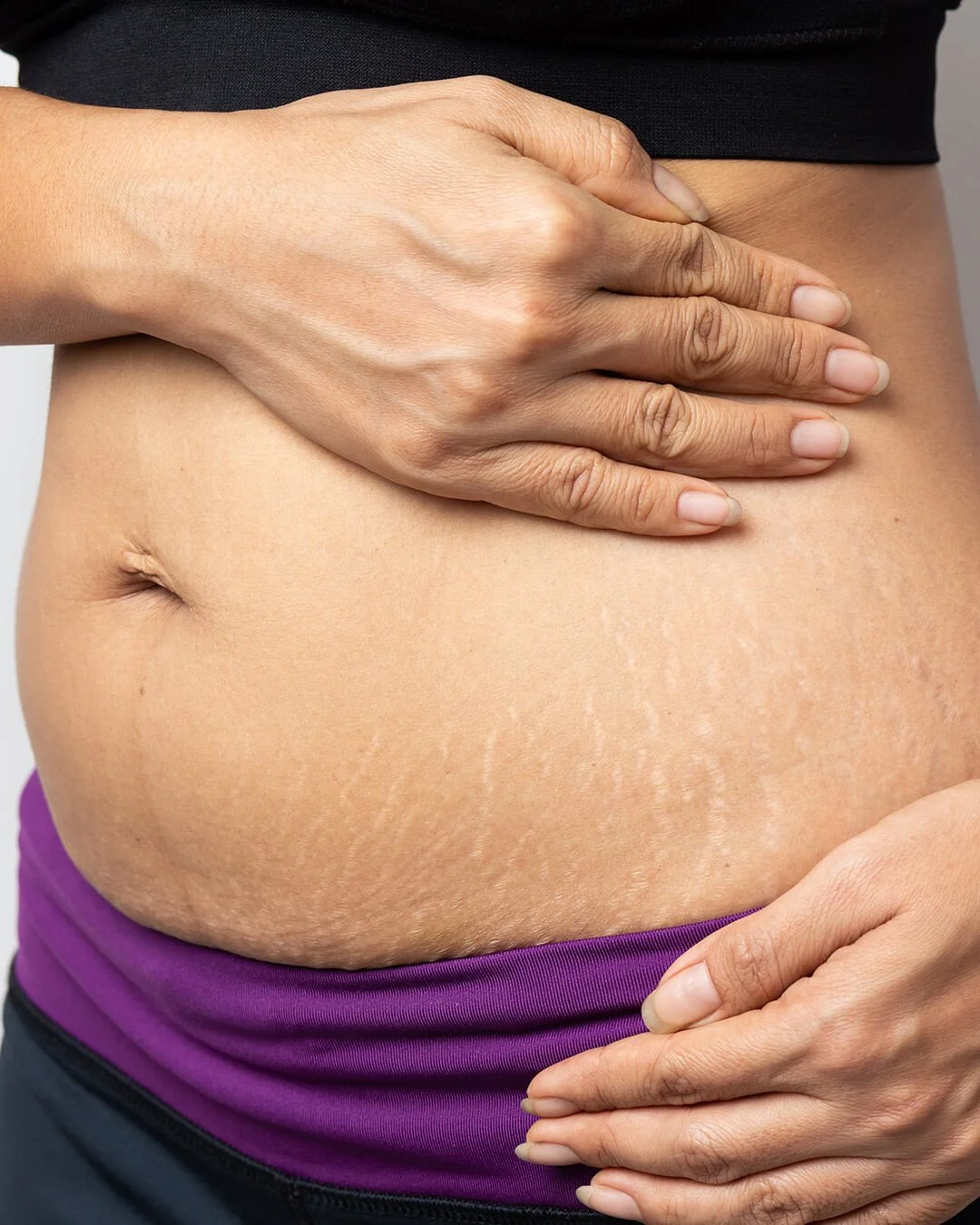 A person with light skin touching their stomach, which has stretch marks, wearing purple and black athletic clothing.