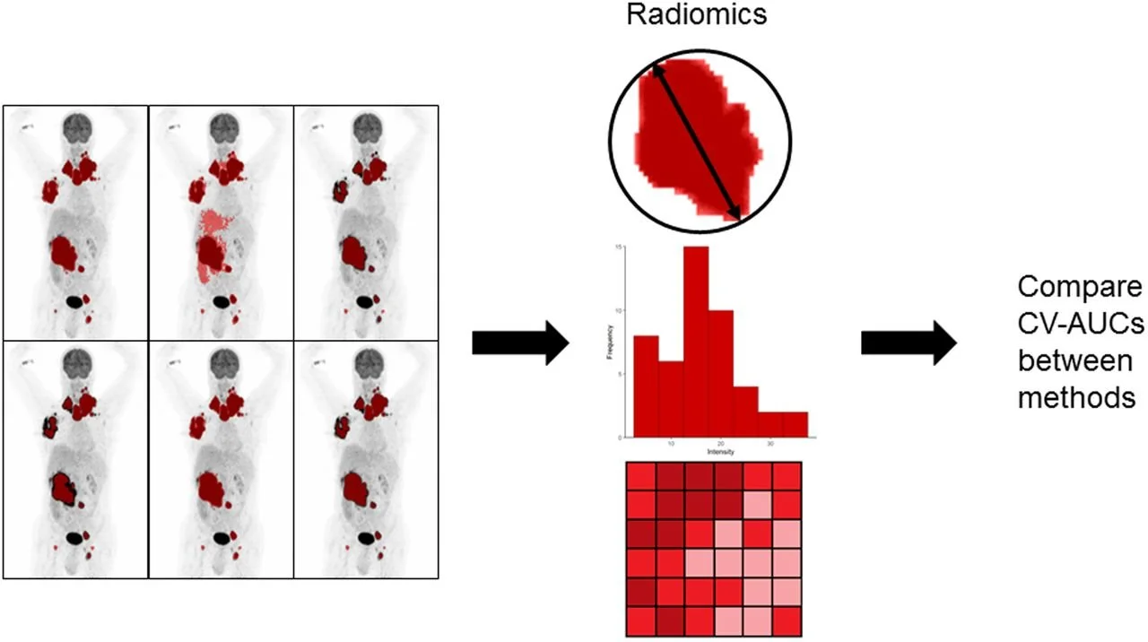 This research was originally published in JNM. Eertink J.J .  Quantitative Radiomics Features in Diffuse Large B-Cell Lymphoma: Does Segmentation Method Matter? Journal of Nuclear Medicine March 2022, 63 (3) 389-395