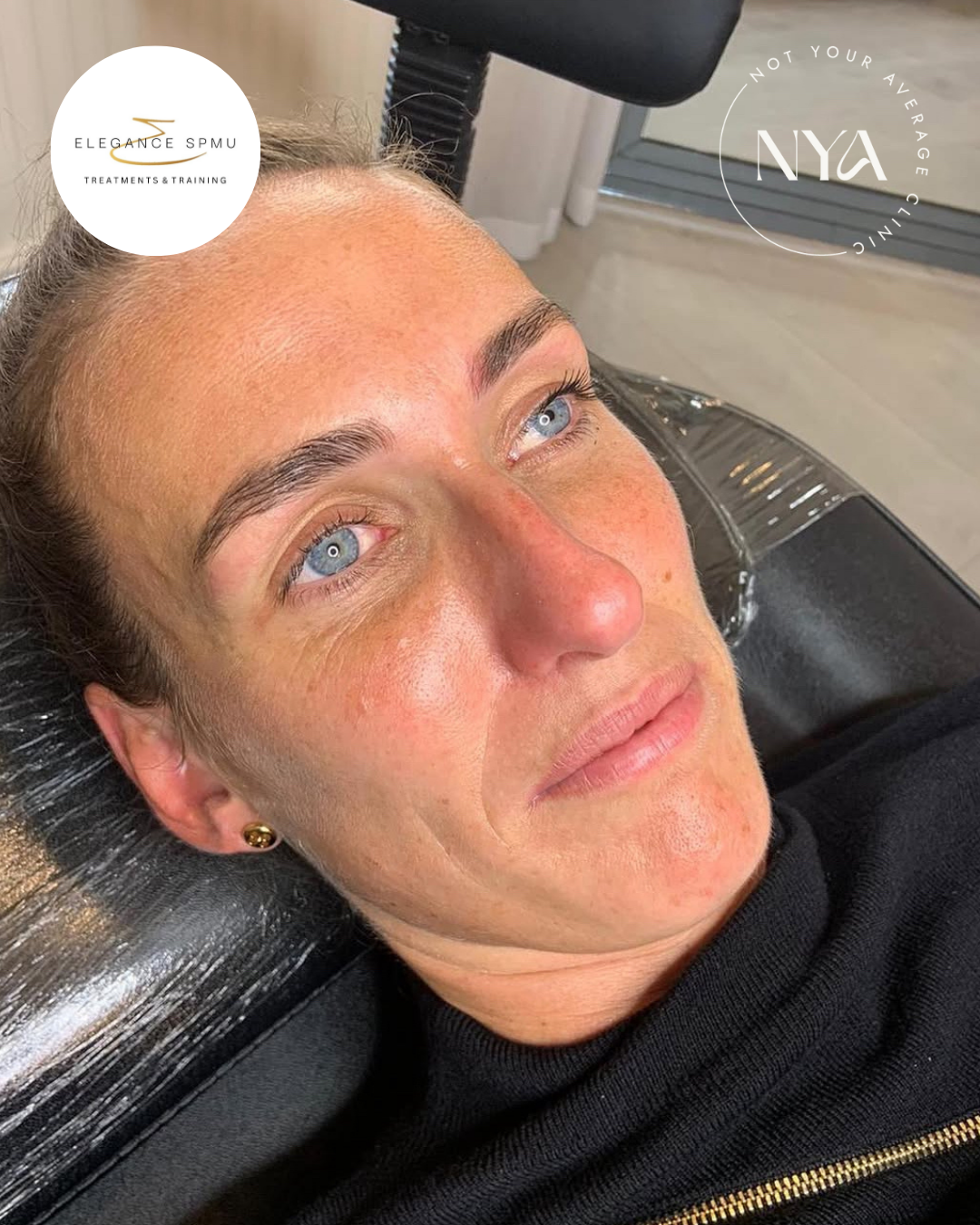 Person lying on a beauty clinic chair, wearing a black top, with logos for Elegance SPMU and Not Your Average Clinic visible in the image.