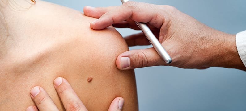 Close-up of a person's shoulder being examined by a doctor using a pen or pointer.