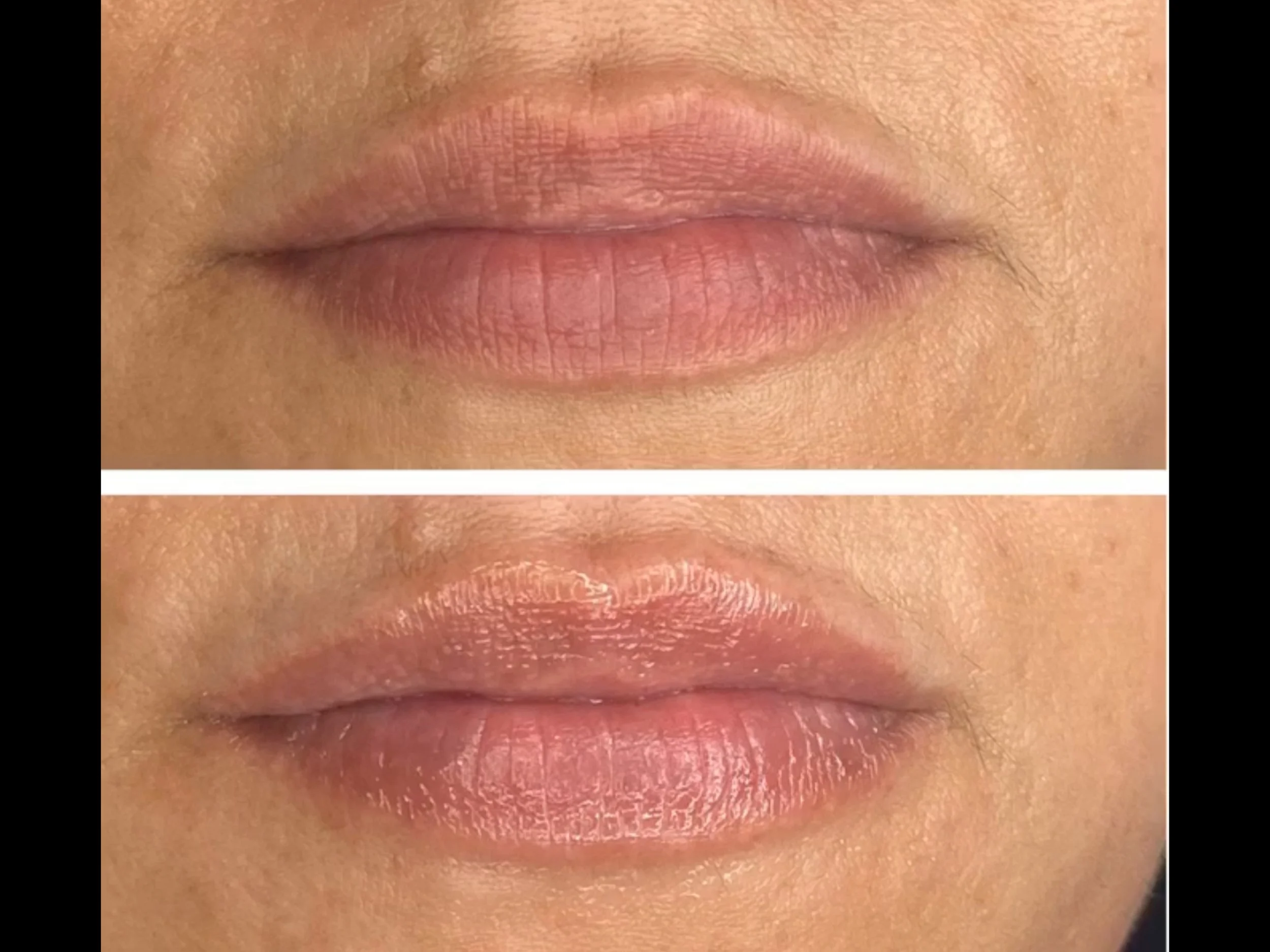 Close-up of lips before and after applying a clear lip gloss or balm, with the top showing natural lips and the bottom showing shiny, moisturized lips.