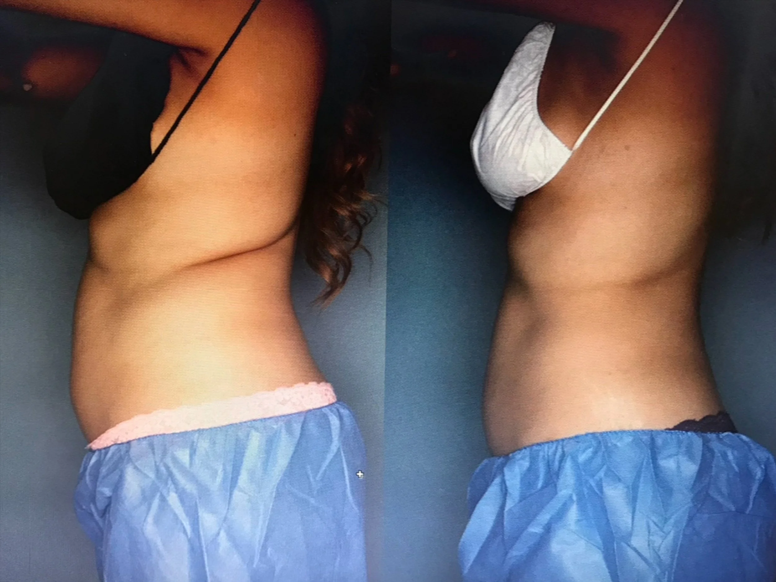 Comparison of two side views of a woman lying on her side, wearing a black top and blue shorts with pink trim on the left, and a white top and blue shorts with black trim on the right.