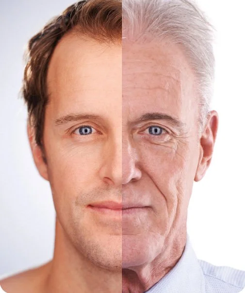 Photo of man with one side young and the other side older, showing volume loss