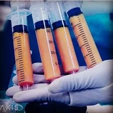 Fat in syringes ready to be injected