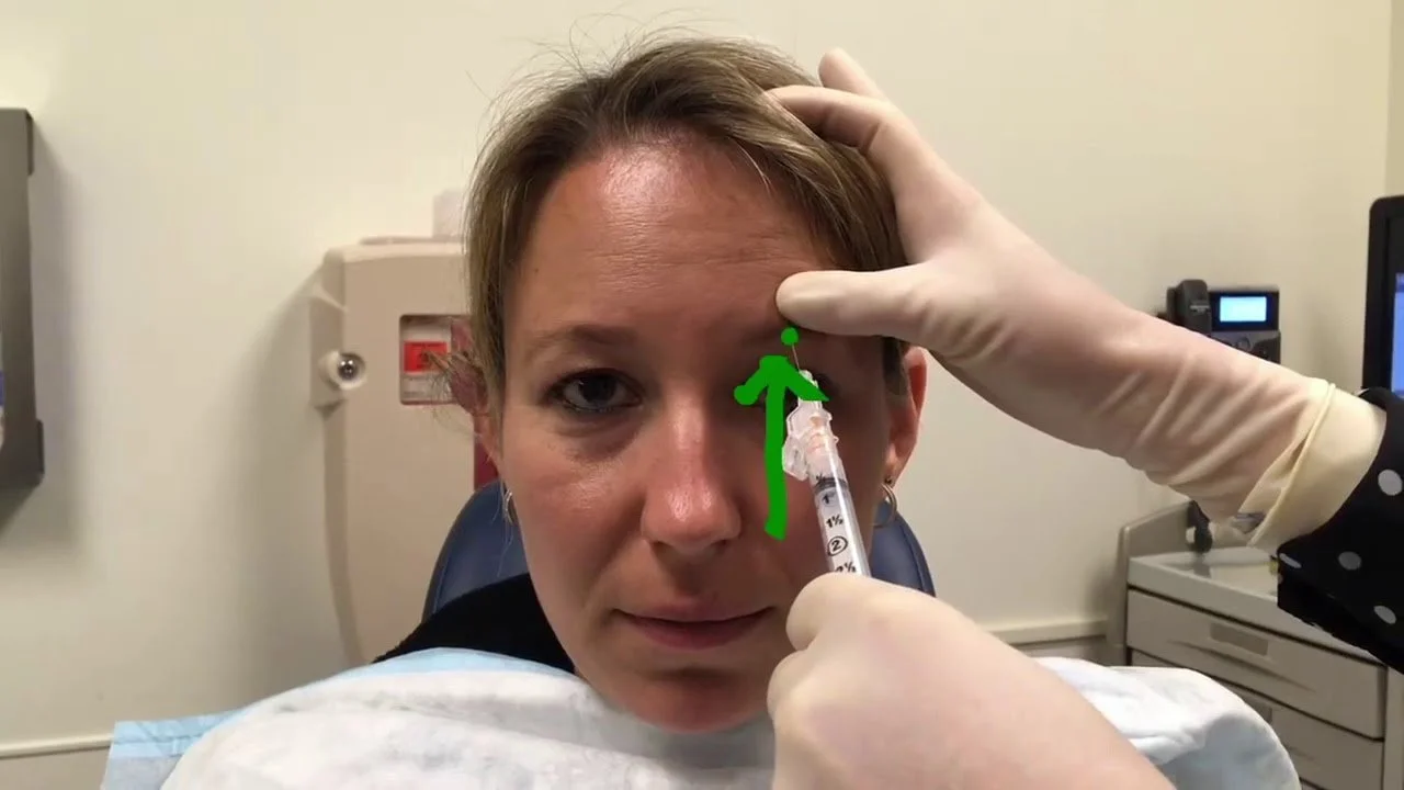 Demonstration of a supraorbital nerve block
