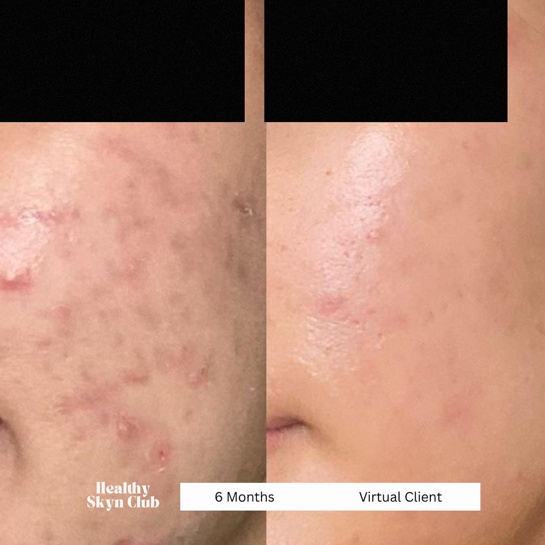 Virtual Skincare Consultations: Do They Really Work? Here’s How You Can Get Real Results From Anywhere