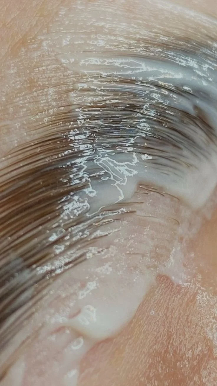 Acne Treatments in Oxford, AL