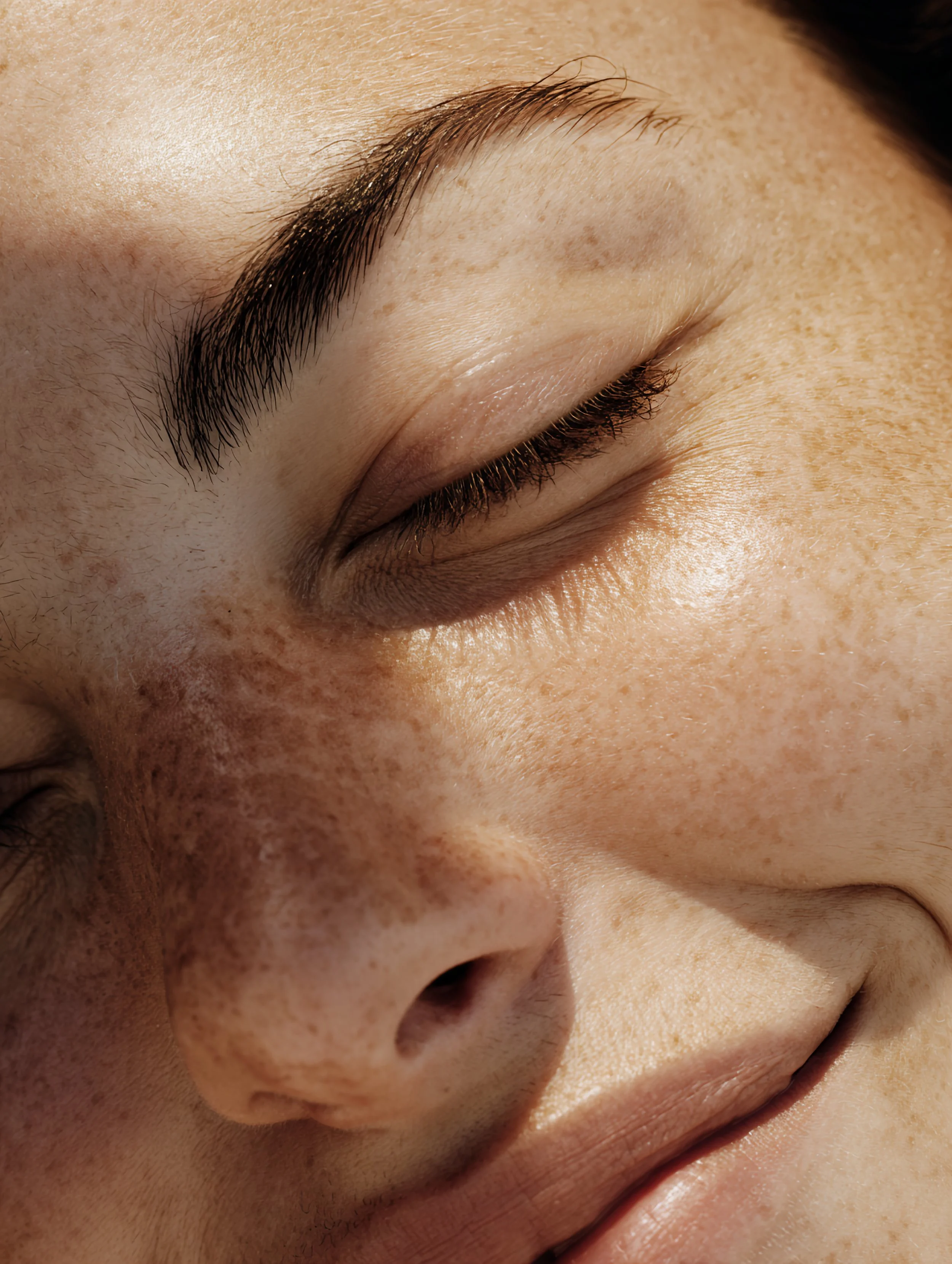 virtual consultations for acne and hyperpigmentation