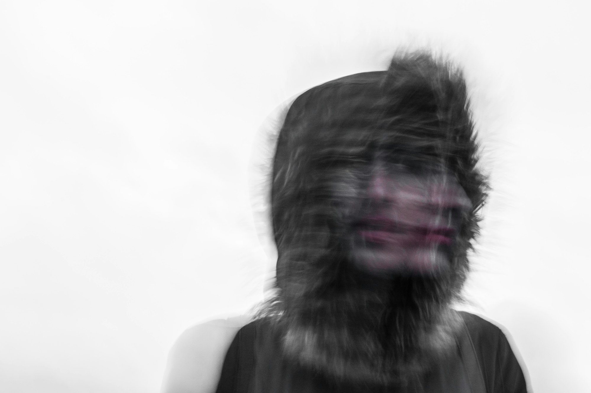 To be, or not to be, that is the question - the difficulty to manage contrast medium and adverse reactions