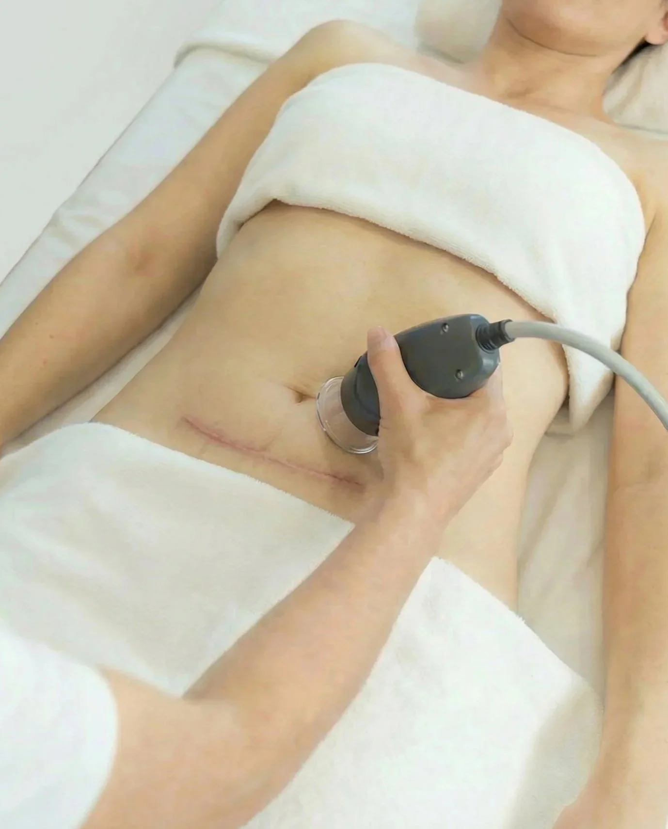 A person lying on a medical bed, receiving ultrasound treatment on their abdominal area, with a nurse or medical technician holding an ultrasound probe.