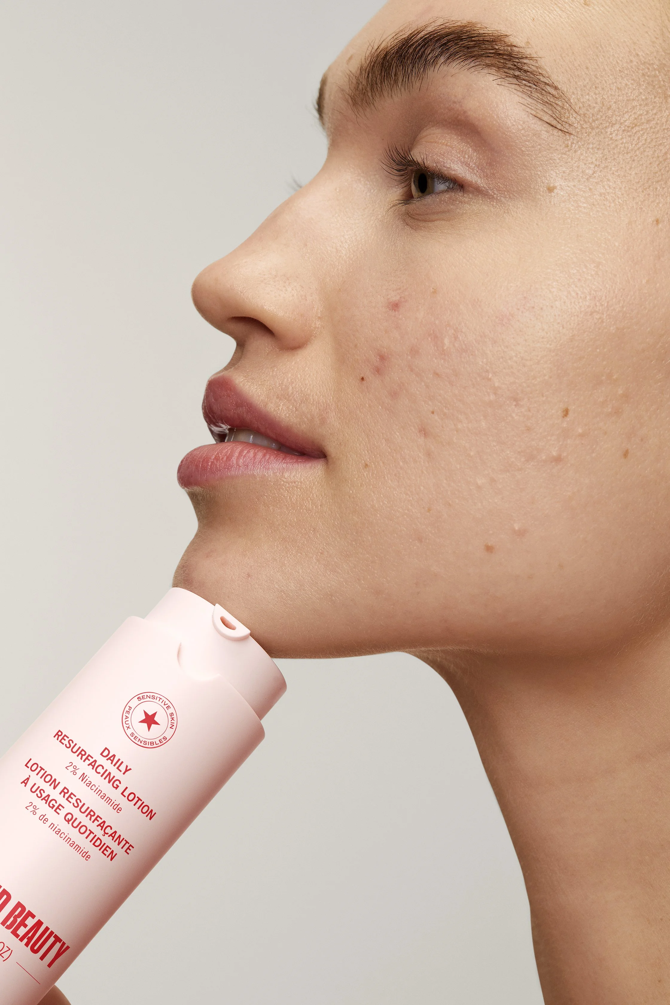 ACNE_LOTION-Model_06.jpg